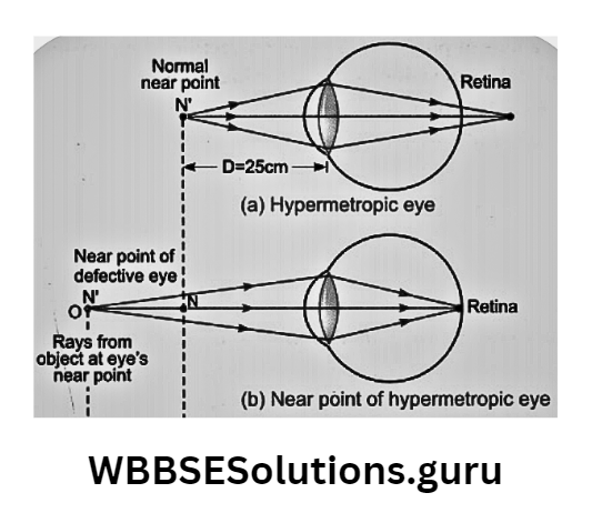 WBBSE Solutions For Class 10 Physical Science And Environment Chapter 5 Light Hypermetropic and correction for hypermertropic eye