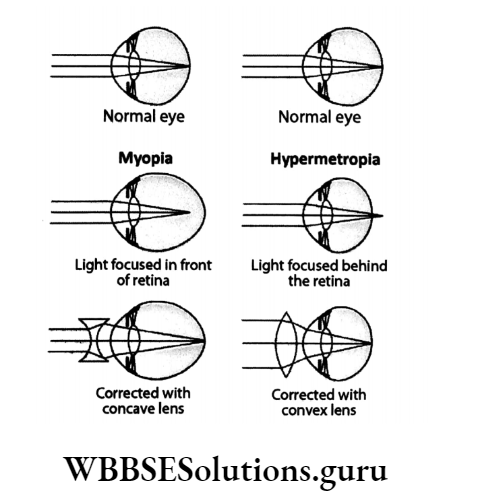 WBBSE Solutions Chapter 1 Control And Coordination In Living Organisms Topic D Response And Physical Coordination In Animals Nervous System conacave convex