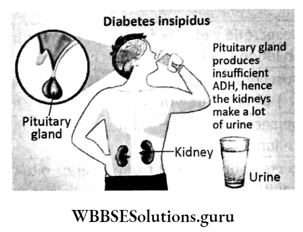 WBBSE Solutions For Class 10 Life Science Chapter 1 Control And Coordination In Living Organisms Topic C Response And Chemical Coordination In Animals Hormones Diabetes insipidus