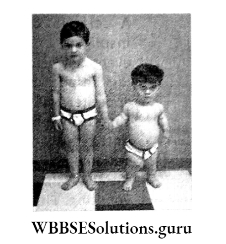 WBBSE Solutions For Class 10 Life Science Chapter 1 Control And Coordination In Living Organisms Topic C Response And Chemical Coordination In Animals Hormones pituitary and dwarfism