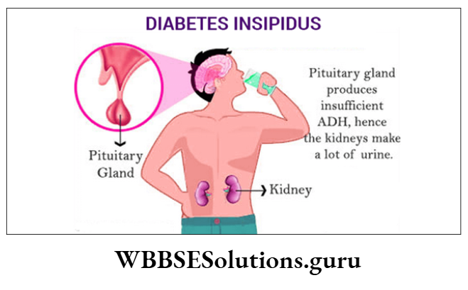 WBBSE Solutions For Class 10 Life Science Chapter 1 Diabetes Insipidus