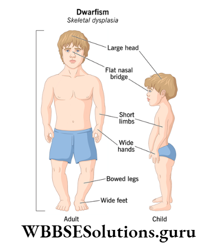 WBBSE Solutions For Class 10 Life Science Chapter 1 Pituitary And Dwarfism