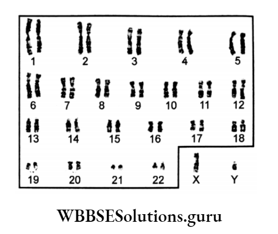 WBBSE Solutions For Class 10 Life Science Chapter 2 Continuity Of Life Topic A Cell Division And Cell Cycle types of choromosone