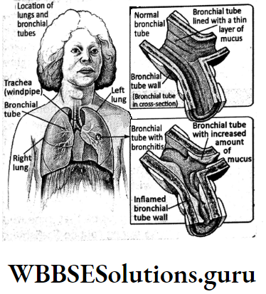WBBSE Solutions For Class 10 Life Science Chapter 5 Environment Its Resources And Their Conservation Topic C Environment And Human Population bronchitis